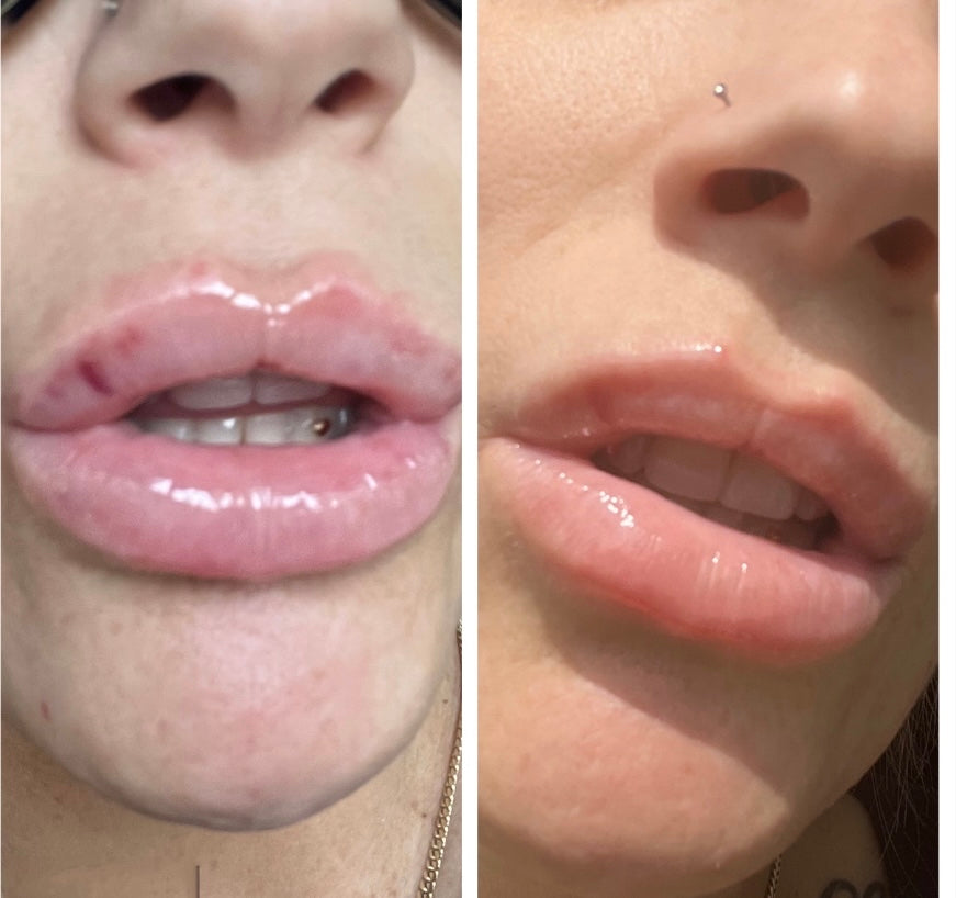bruise bullie lip gloss