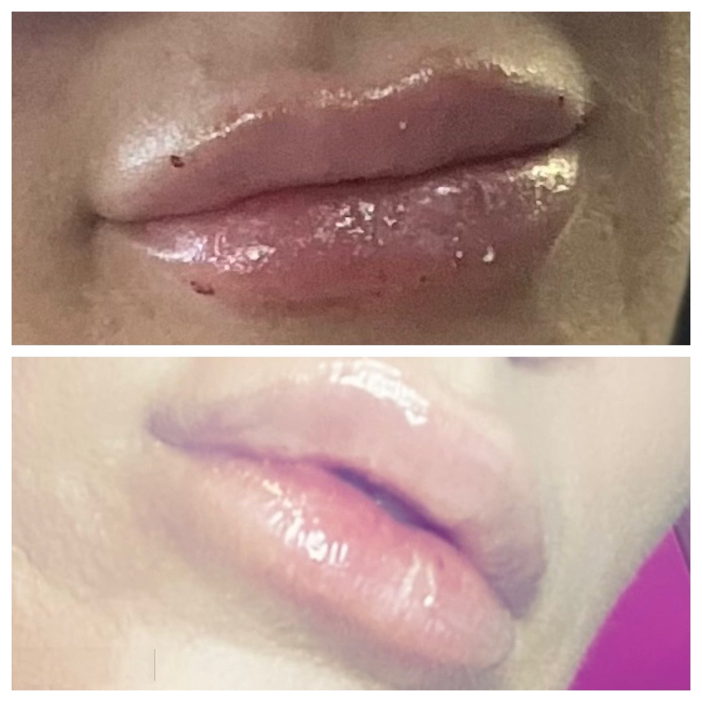 Bruise Bullie-Arnica Infused Lip Gloss | Wholesale