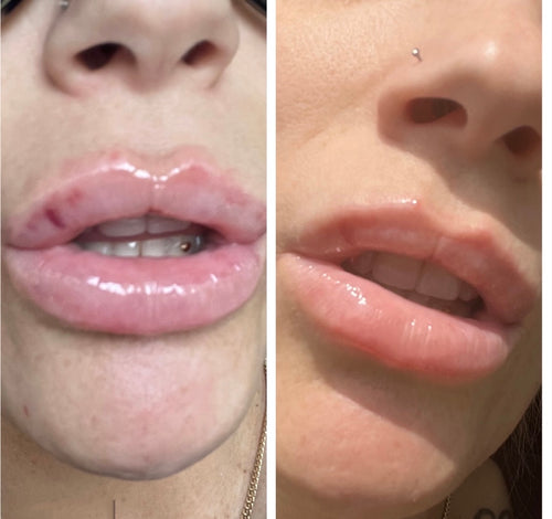 bruise bullie lip gloss