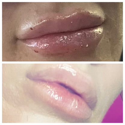 Bruise Bullie-Arnica Infused Lip Gloss | Wholesale