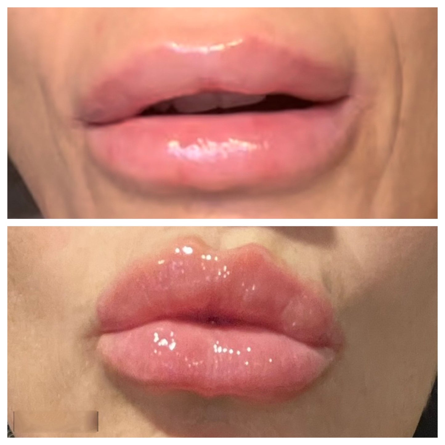 Private-Label | Arnica Infused Lip Gloss | 5ml | Choose 25, 50, 100